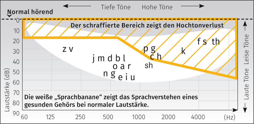 Sprachbanane Sprachbanane